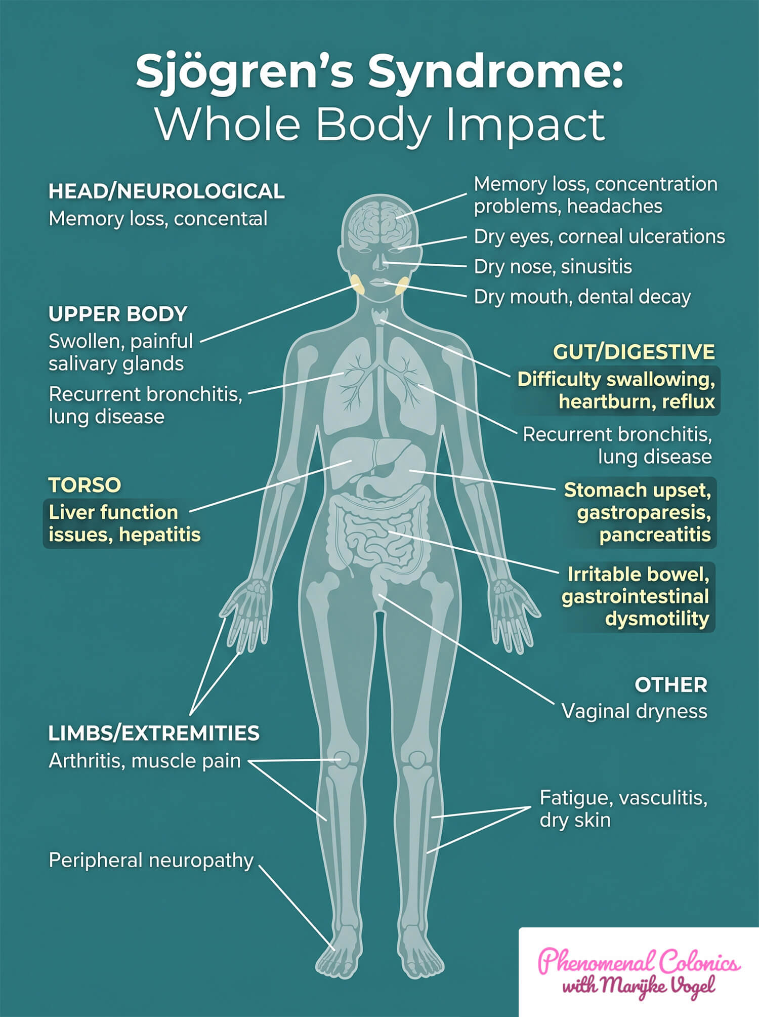 Sjogrens syndrome whole body symptoms infographic showing gut health digestive problems including irritable bowel gastroparesis alongside dry eyes mouth