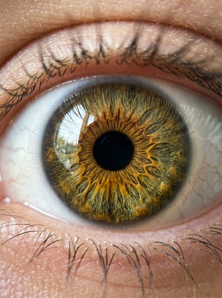 Iridology London — iris examination with Marijke Vogel, Phenomenal Colonics Belsize Park
